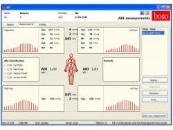 boso ABI-System 100 PWV – Detectarea bolii arteriale periferice și evaluarea rigidității / elasticității pereților arteriali