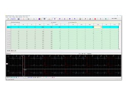 ASPEL HLT-712 v.301– Holter ECG 12 canale cu Software de analiză  profesional  ASPEL HolCARD 24W