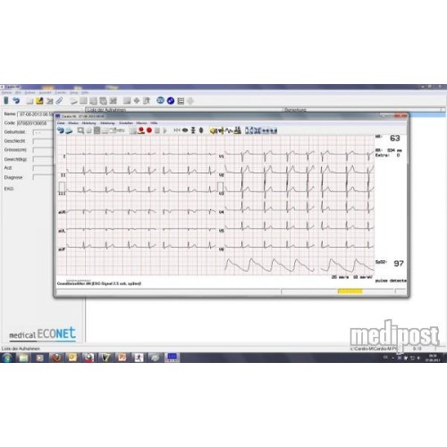 Cardio M-PC PC ECG System – 12 canale, cu interpretare automată