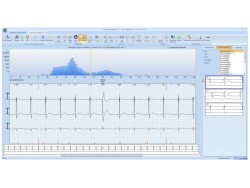 Software Cardio M-Holter
