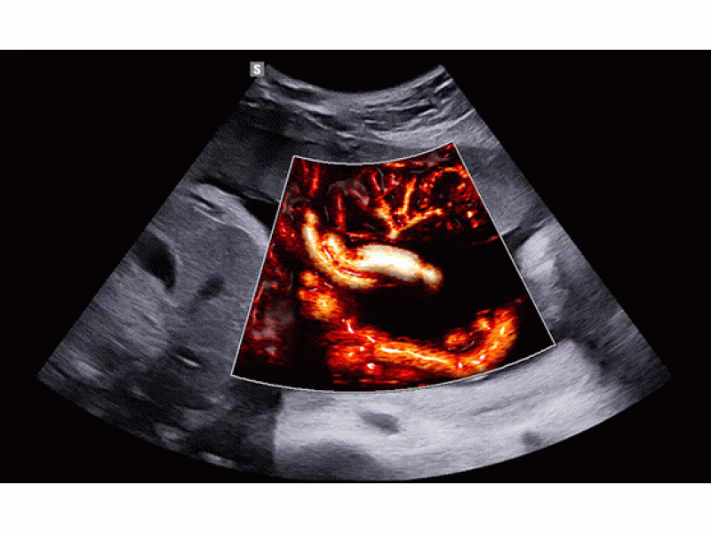 Ecograf Samsung HERA W9