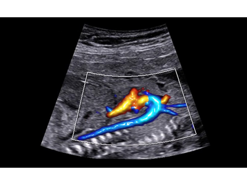 Ecograf Samsung HERA W9