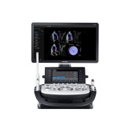 Samsung HS70A – Ecograf high-end pentru OB/GYN și imagistică generală