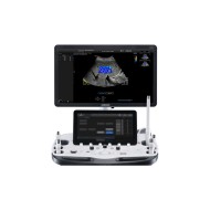 Samsung RS85 Prestige – Ecograf avansat pentru diagnostic precis și imagistică de înaltă performanță