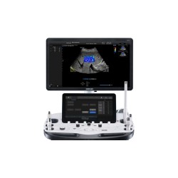 Samsung RS85 Prestige – Ecograf avansat pentru diagnostic precis și imagistică de înaltă performanță