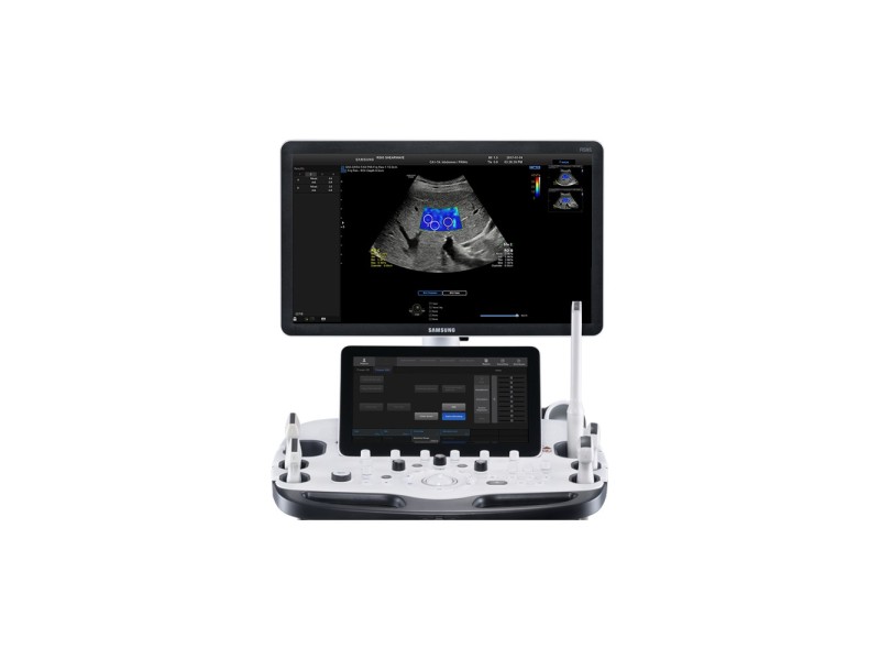 Samsung RS85 Prestige – Ecograf avansat pentru diagnostic precis și imagistică de înaltă performanță