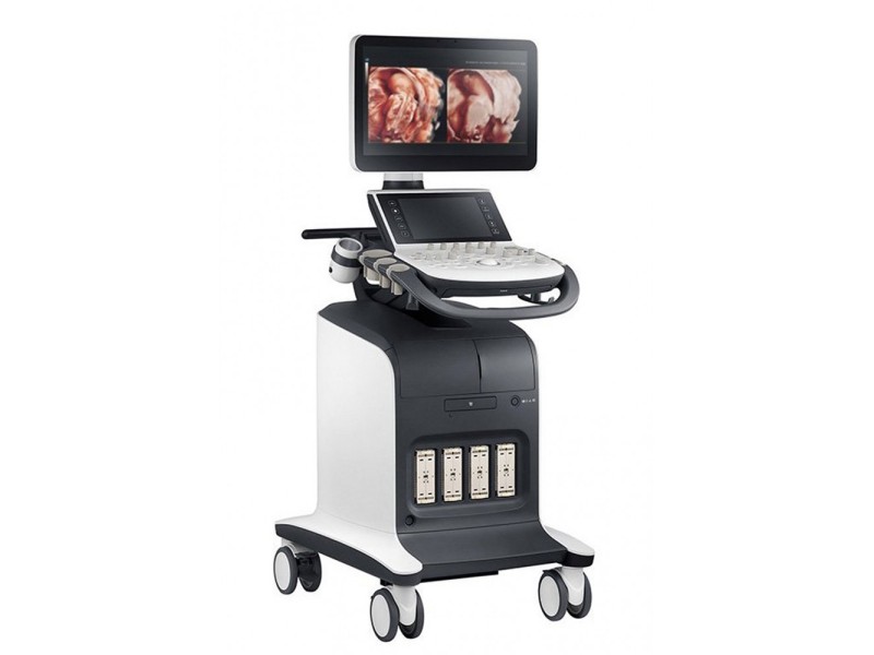 Samsung WS80A – Ecograf premium pentru obstetrică și ginecologie (OB/GYN)