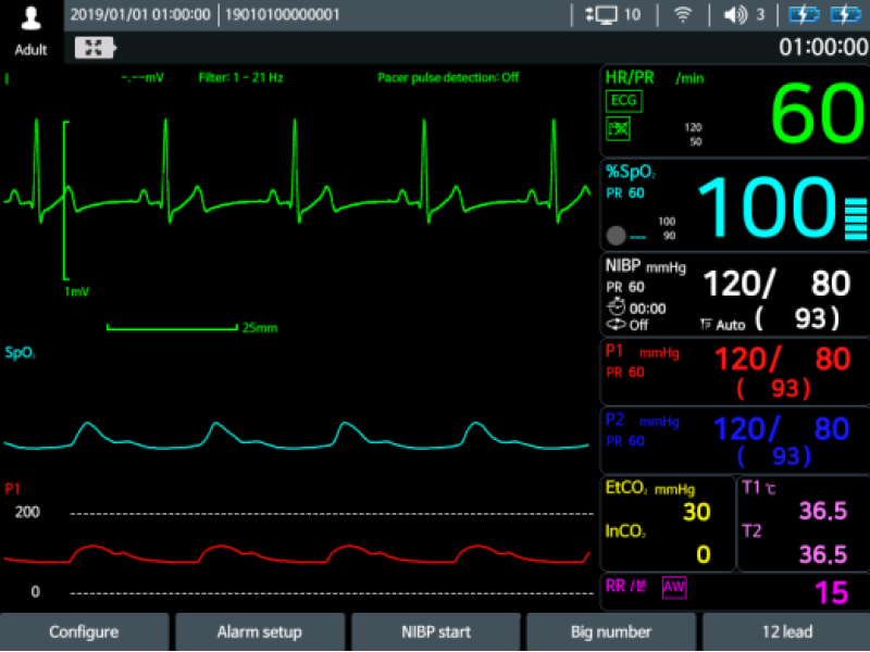 Defibrilator defiMASTER Advance – Standard + 12ch ECG NIBP/Temp si EtCo2