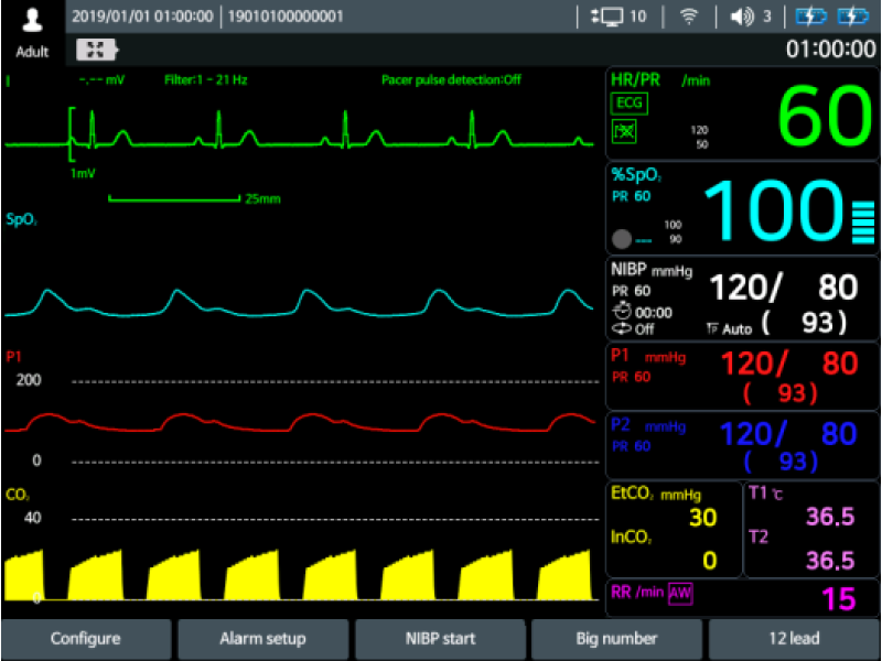 Defibrilator defiMASTER Advance – Standard + 12ch ECG NIBP/Temp si EtCo2