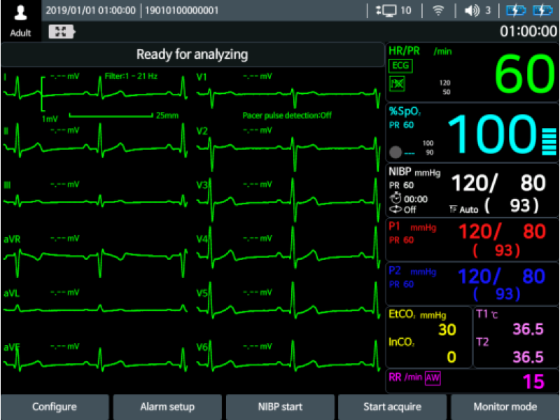 Defibrilator defiMASTER Advance – Standard + 12ch ECG NIBP/Temp si EtCo2