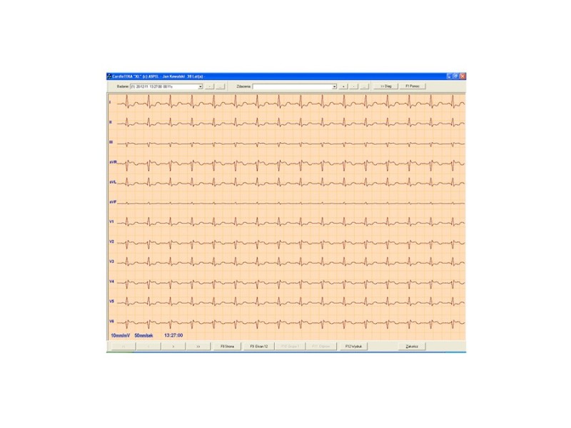 Software ASPEL CardioTEKA v.211 SOFT HL7