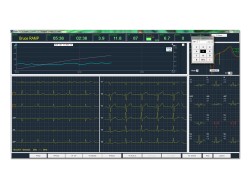 Software ASPEL CardioTEST pentru test de efort