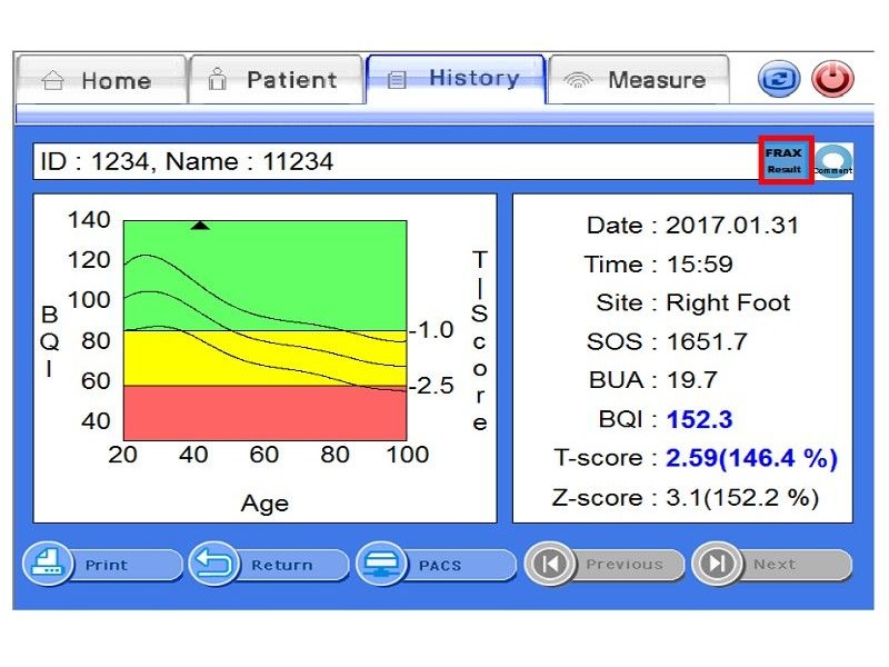 INUS S Osteodensitometru cu ultrasunete si ecran tactil