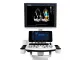 Ecograf Doppler CHISON CBit 4