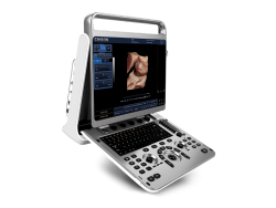 Ecograf Doppler Portabil CHISON EBit 30