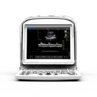 Ecograf Portabil Chison ECO3 Expert