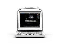 Ecograf Portabil Chison ECO3 Expert