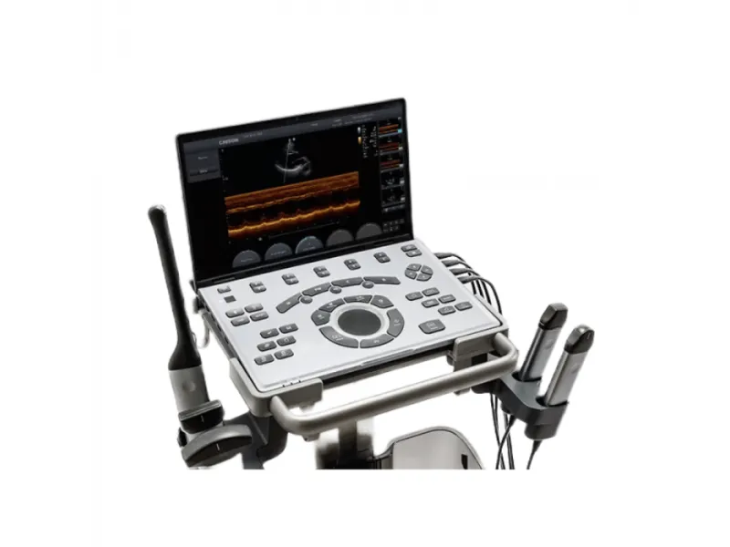 Ecograf tip laptop SonoAir 60 CHISON