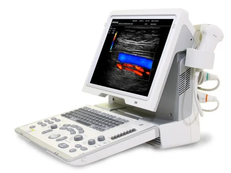 Ecograf Portabil Mindray Z6