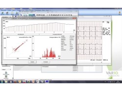 ECG de repaus cu Cardio M-PC