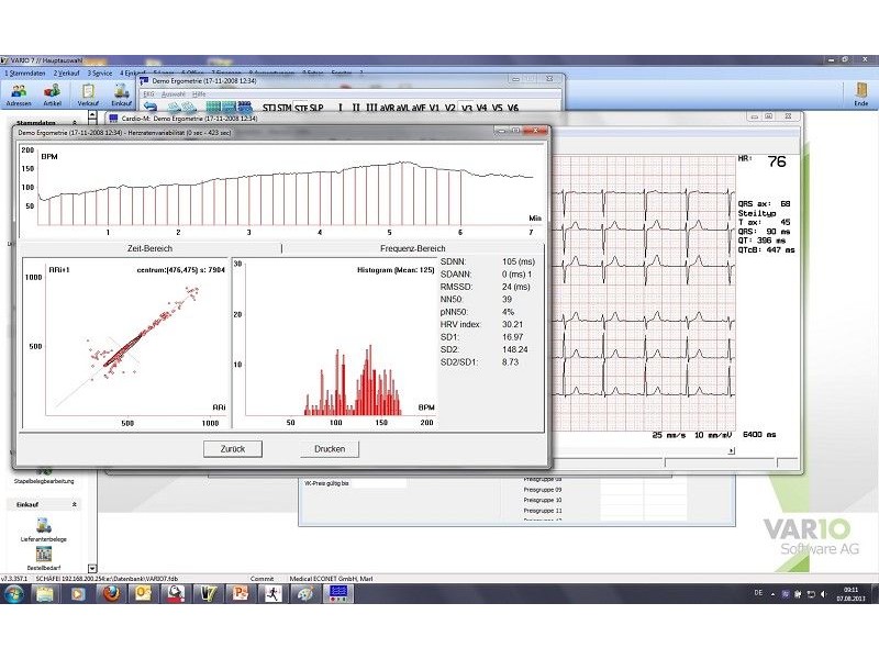 ECG de repaus cu Cardio M-PC