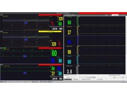 Software pentru monitor funcții vitale M20