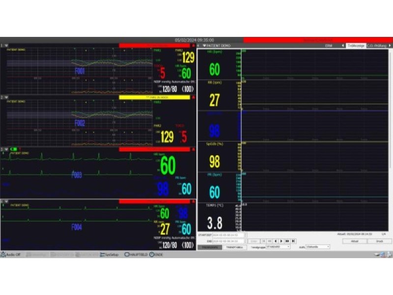 Software pentru monitor funcții vitale M20