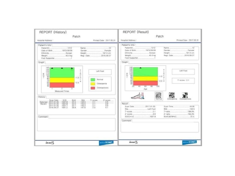 INUS S Osteodensitometru cu ultrasunete si ecran tactil