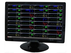 Software statie centrala monitor functii vitale