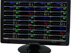 Software statie centrala monitor functii vitale
