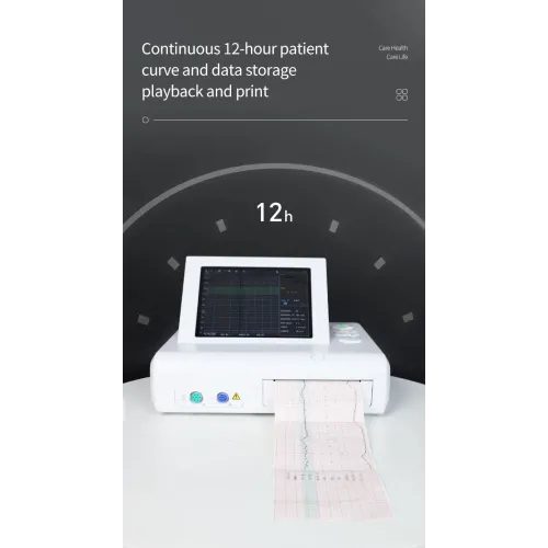 Monitor Fetal CMS800G – Monitorizare 24/7 a Ritmului Cardiac Fetal și a Mișcărilor Fetale