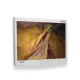 Linie Videoendoscopie HDTV IMAGINA Pentax
