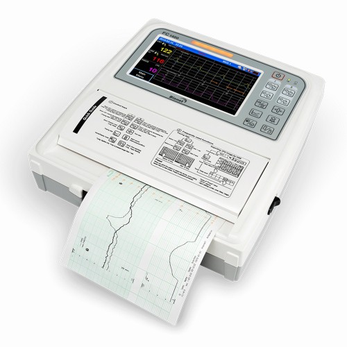 Monitor fetal touchscreen FC 1400 Bionet, Analiza NST (Non-Stress Test)